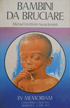 Carica immagine di copertina locale